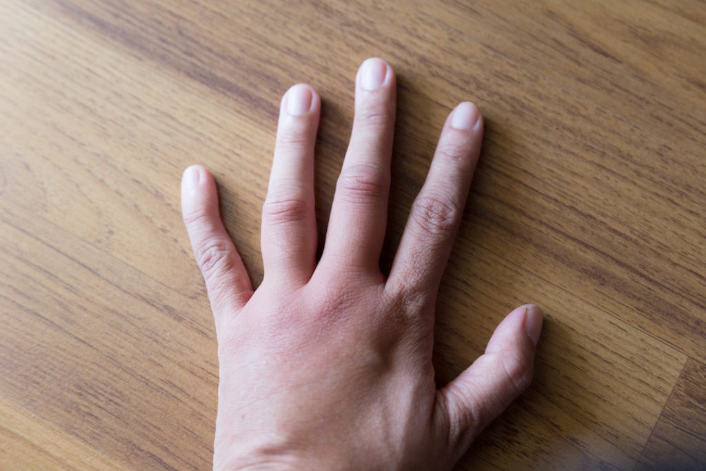 10 Reasons You Have Swollen Fingers - Geelong Medical & Health Group